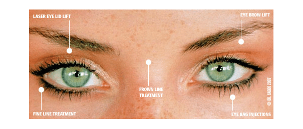 Veins Under Eyes: Causes & Treatment Options