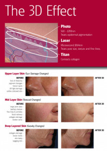 The 3D Effect of the Titan Laser