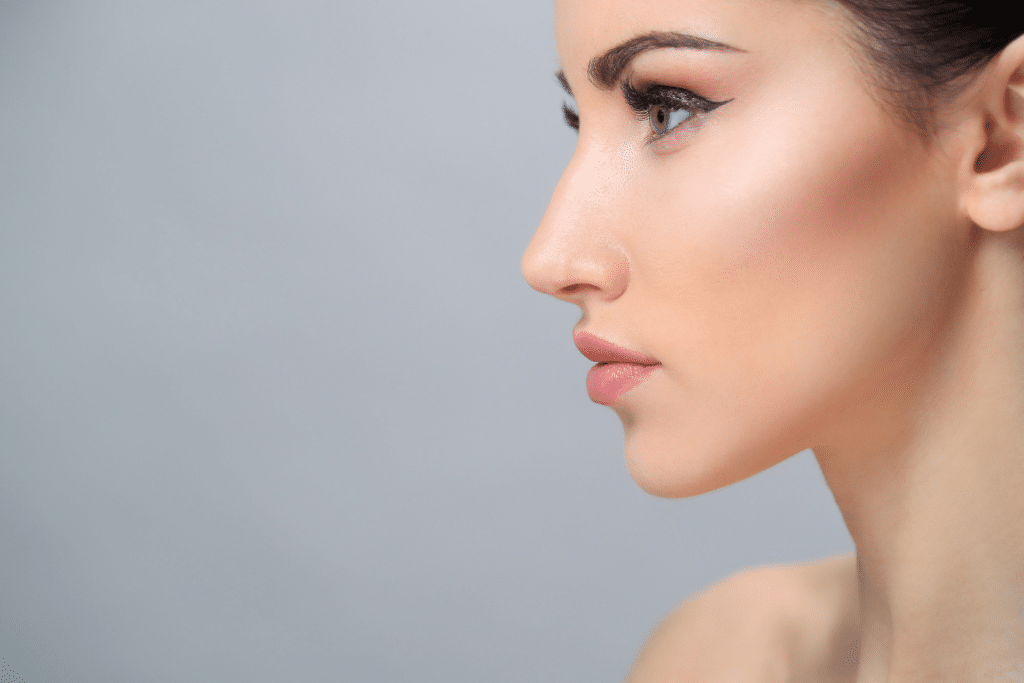 Non-Surgical Nose Reshaping lady with Ski slope nose