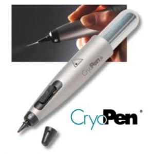 Cryopen Treatment For Wart Removal