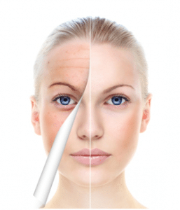 Face Treatments to Fight Ageing