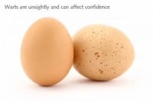 2 Eggs Representing Patients With & Without Warts
