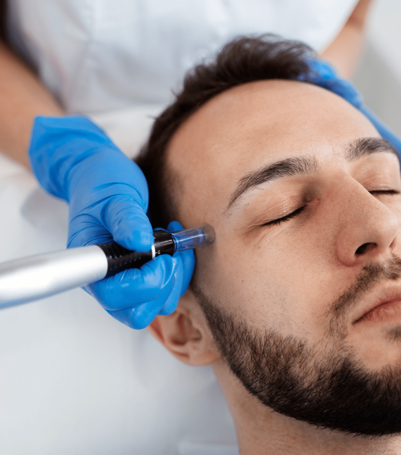 Microneedling Skin Rejuvenation