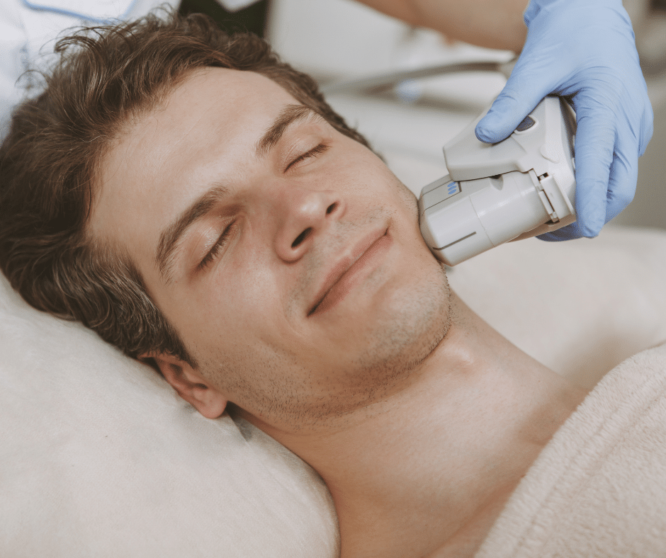 CO2 laser resurfacing for acne scarring