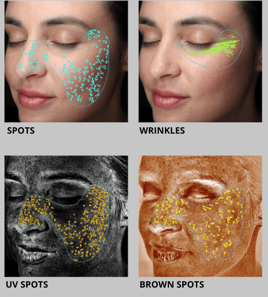 spots, wrinkles, UV spots and brown spots