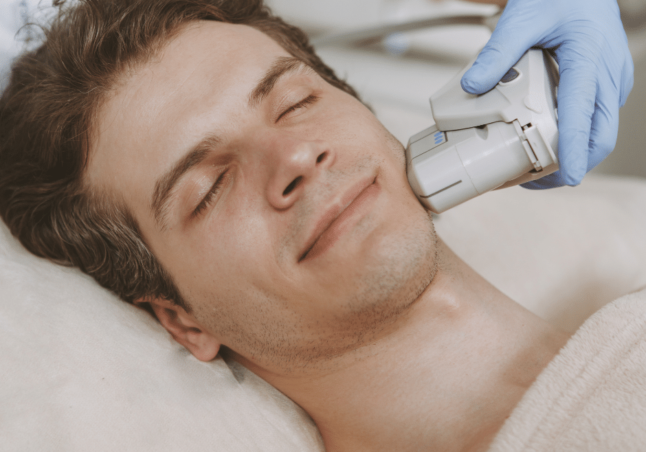 CO2 laser resurfacing for acne scarring