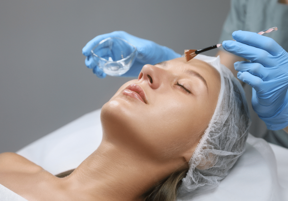 chemical peels and resurfacing